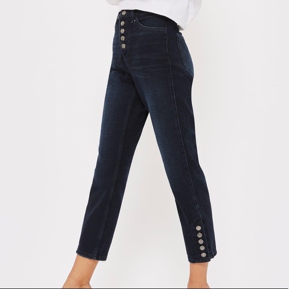 topshop button jeans